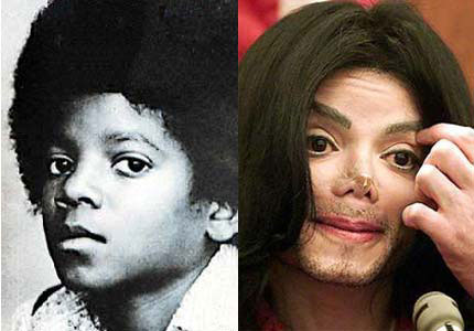 Depois de mudanças radicais na fisionomia, e com notáveis traços de desequilíbrios, Michael Jackson morreu no dia 25 de junho em Los Angeles (Califórnia), após sofrer parada cardíaca. Com 50 anos ele preparava a nova temporada do seu novo show This is it